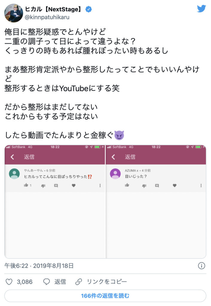 ヒカルの整形疑惑