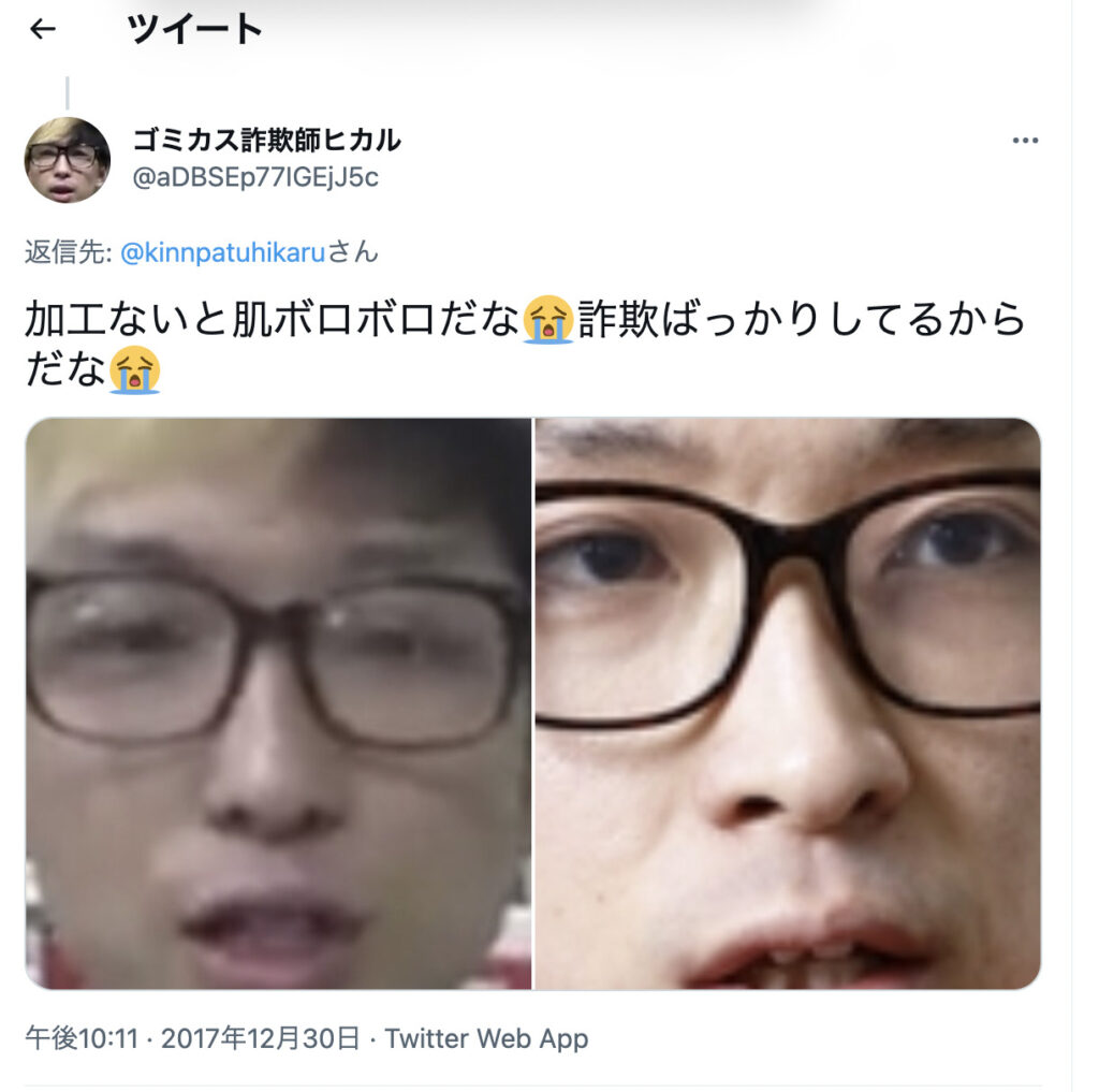 ヒカル整形