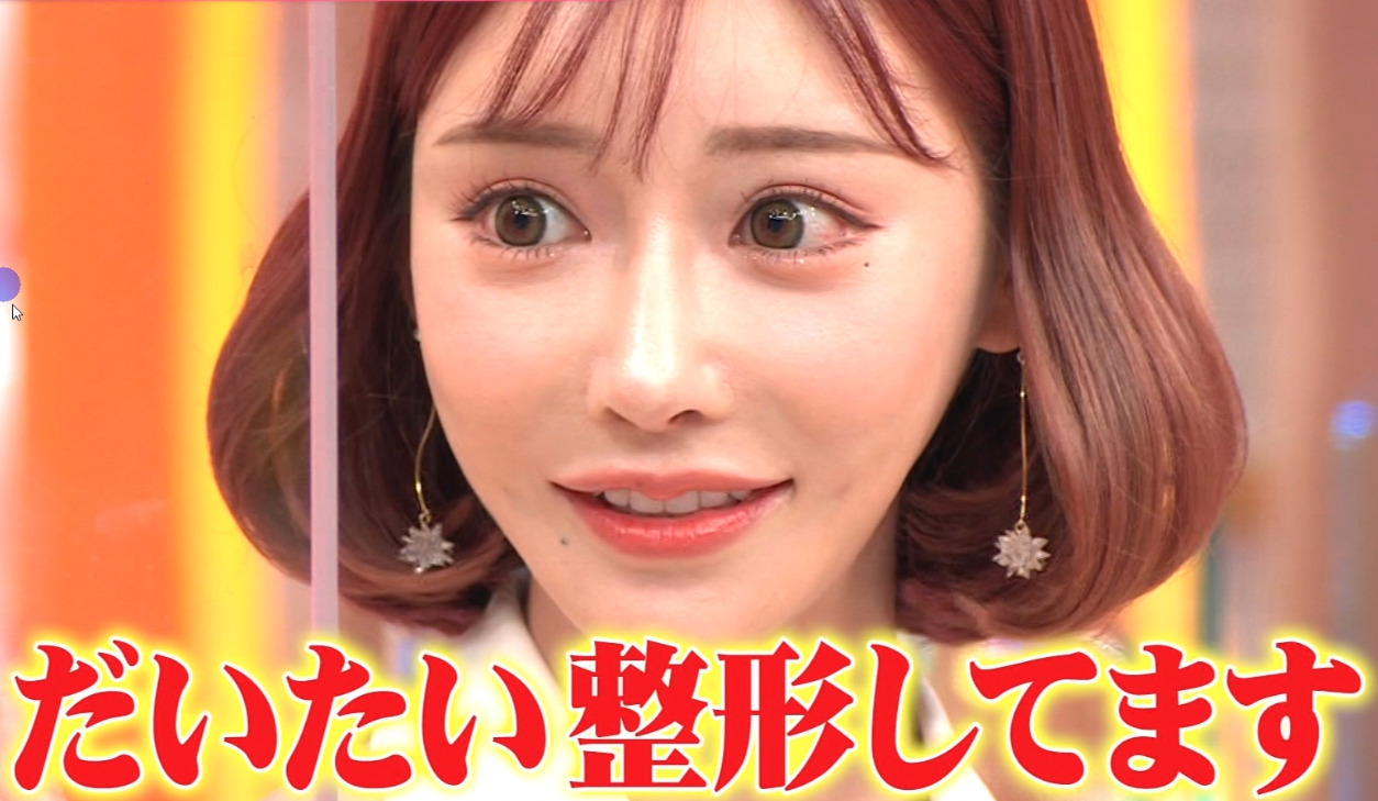 【整形モンスター】明日花キララの整形費用は1000万円超えだった！？昔から顔が変わりすぎ？