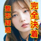 【画像検証】本田翼の整形疑惑を完全論破してみた結果www『整形』じゃなくね？